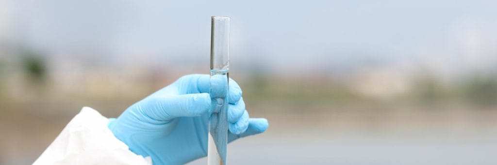 חיטוי מאגר מבנה